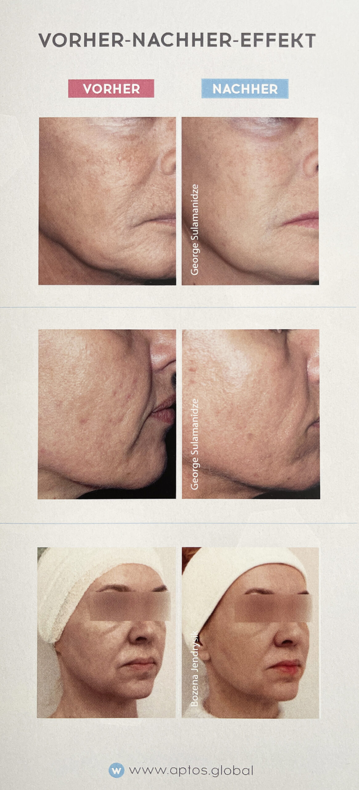 APTOS FADENLIFTING StayVisible!